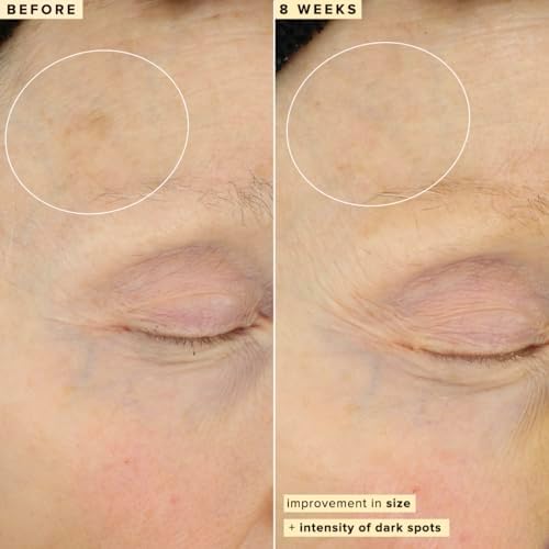 Farmacy 10% Vitamin C Serum for Face - Waterless - Dark Spot Remover for Face - Antioxidant with Ferulic Acid (30 ml)