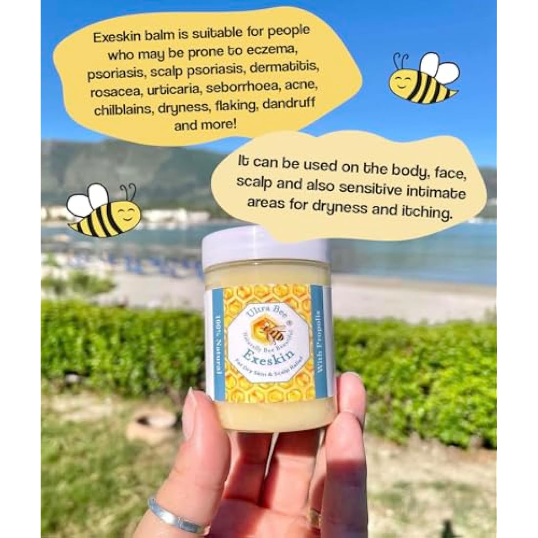 100% Natural Exeskin Balm 200ml - Soothes Dry Sensitive Skin and Dry Itchy Scalp - Also Suitable for People Prone to Eczema Psoriasis, Dermatitis, Rosacea