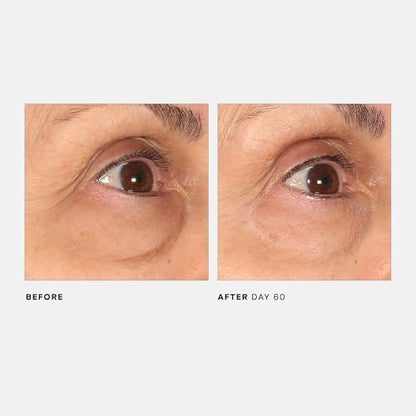 U Beauty The RETURN Eye Concentrate - Anti-Aging Eye Cream with Peptides and Antioxidants for Brighter and Tighter Under Eyes, Reduce Fine Lines, Puffiness & Dark Circles - 0.5 fl oz