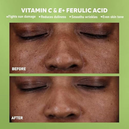 DERMAdoctor Kakadu C Vitamin C Serum – Brightening Anti-Aging Face Serum for Dark Spots, Uneven Skin Tone & Fine Lines – 30 Millilitres (20282-7)