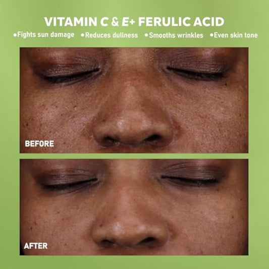 DERMAdoctor Kakadu C Vitamin C Serum – Brightening Anti-Aging Face Serum for Dark Spots, Uneven Skin Tone & Fine Lines – 30 Millilitres (20282-7)