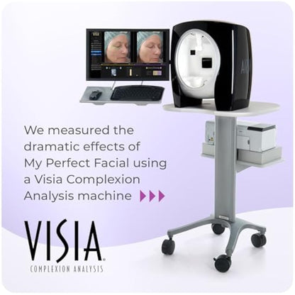 My Perfect Facial, Penny Lane, 10 Treatment Kit, Instant Results, Clinically Proven, Anti-Ageing 3-Stage Facial Contouring and Skin Tightening System. Salon Grade Results, As Seen on TV.