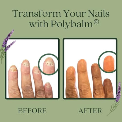 Polybalm Topical Nail Application | Scientifically Tested and Proven | Only Pure Plant Based Ingredients | Made by a Trusted UK Company | Nail Health Treatment Balm