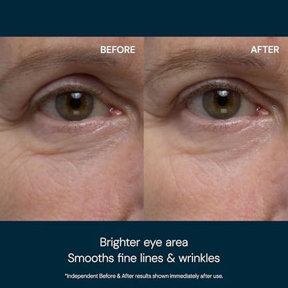 ELEMIS Pro-Collagen Eye Treatment, Eye Revive Mask, Vitality Eye Cream, Under Eye Gel Mask – Anti-Aging, Hydrating & Brightening Skincare for Puffiness, Dark Circles & Fine Line