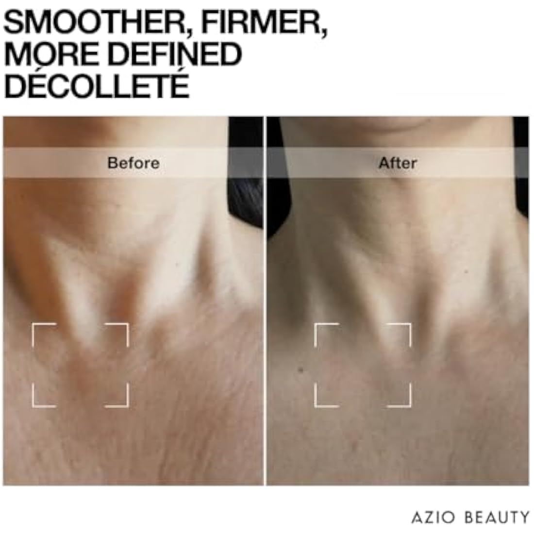 Azio Beauty Lift Factor Neck & Chest Cream 50ml – Firming, Lifting, and Hydrating Anti-Aging Cream for a Youthful Neck and Décolleté