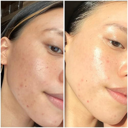 Sand & Sky Tasmanian Spring Water Intense Hydration Face Mask with Pentavitin & Hyaluronic Acid - Barrier Boosting Mask for Sensitive Skin, Soothes Redness