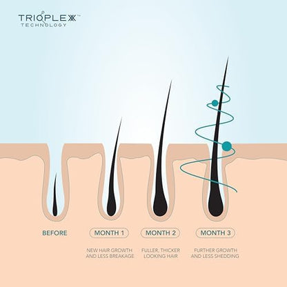 WE ARE PARADOXX Scalp Serum 50ml, Thicker Healthier Hair, Trioplexx Technology for Scalp and Hair Follicle Stimulation, Advanced Growth, Beauty Gift, Travel Size, Vegan and Cruelty Free