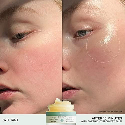 REN Clean Skincare Evercalm™ Overnight Recovery Balm | Intensively Nourishes Skin Barrier to Hydrate & Soothe during Sleep | Calms Red or Irritated Skin | Cruelty Free | Step 4: Recover