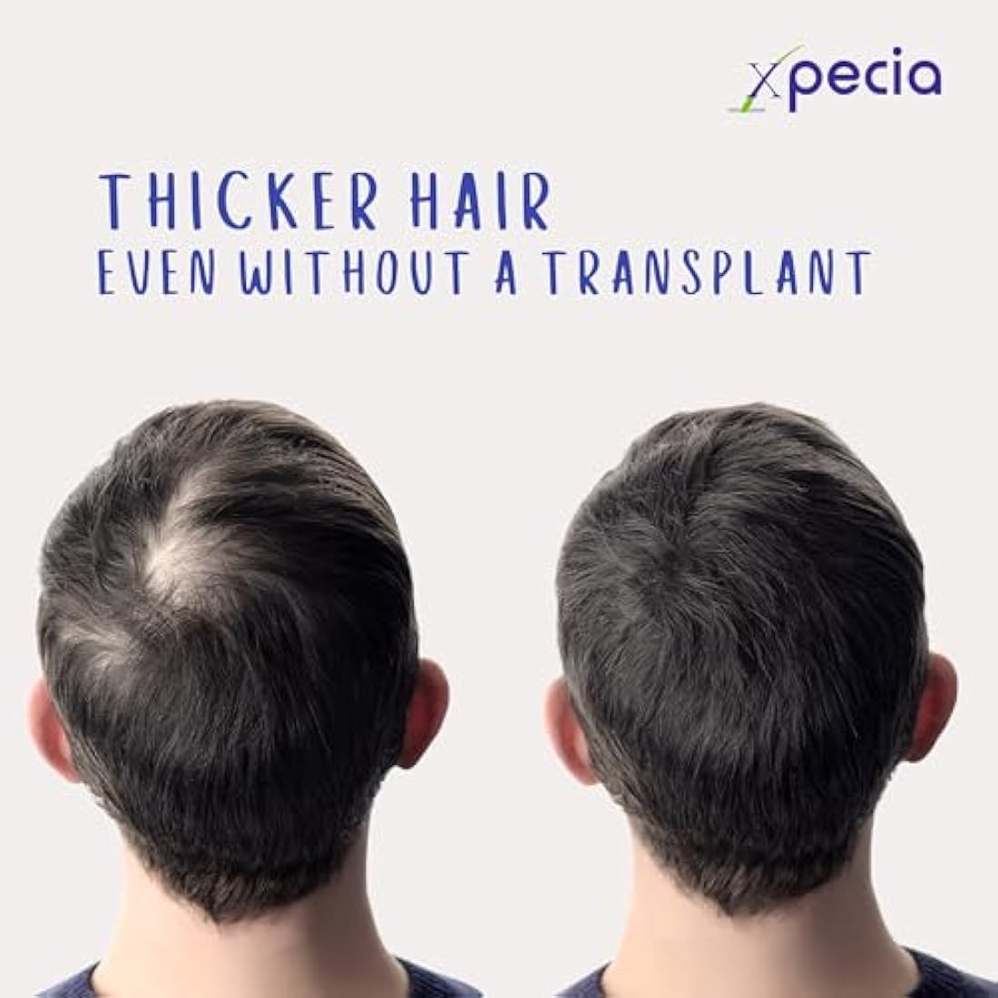 XPECIA FOR MEN ANTI HAIR LOSS DHT BLOCKER NEW HAIR GROWTH FORMULA (180 Tablets)