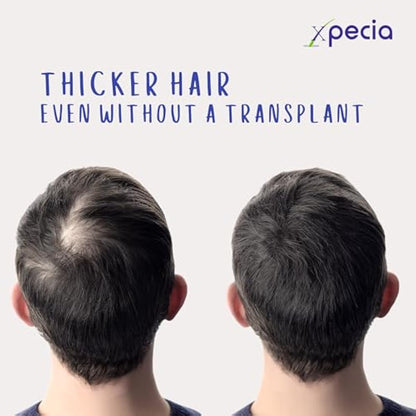 XPECIA FOR MEN ANTI HAIR LOSS DHT BLOCKER NEW HAIR GROWTH FORMULA (180 Tablets)