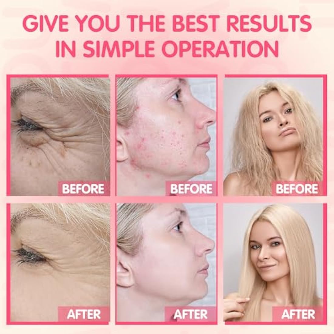 High Frequency Facial Machine - TUMAKOU Neon Portable High Frequency Facial Skin Light Therapy Wand Device with 4 Electrodes for Acne, Wrinkle Removal, Hair Regrowth, Skin Tightening, Anti Aging