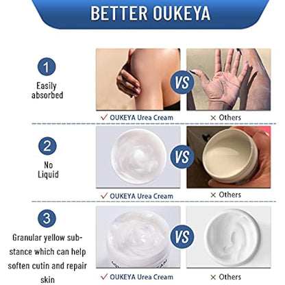 OUKEYA Urea Cream 40 Percent, Urea Foot & Hand Cream for Cracked Heels and Dry Skin, Urea Lotion for Deep Moisturizing, Callus Remover Nourishes Soften, Maximum Strength(150g (Pack of 4))