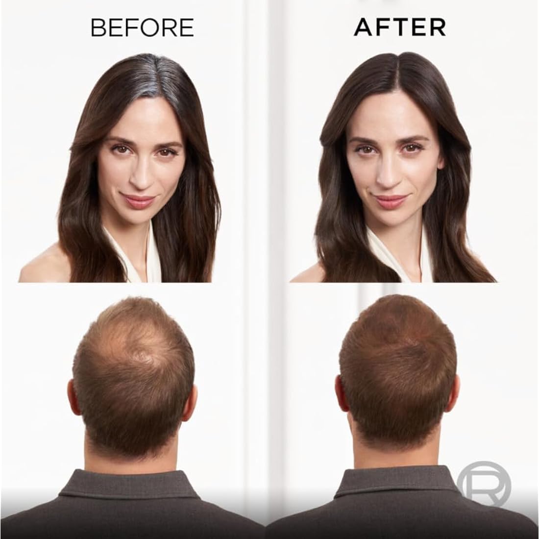 L’Oréal Paris Magic Retouch Instant Root Concealer Spray, Quick Grey Coverage, Easy Application, Shade: Dark Brown, 75ml