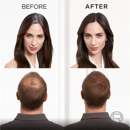 L’Oréal Paris Magic Retouch Instant Root Concealer Spray, Quick Grey Coverage, Easy Application, Shade: Dark Brown, 75ml