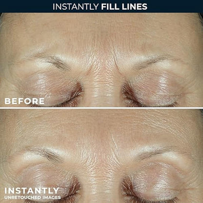 RoC Derm Correxion Serum Fill + Treat for Face, Neck, & Jawline, Wrinkle Filler, Advanced Retinol & Triple Hyaluronic Acid - 15ml