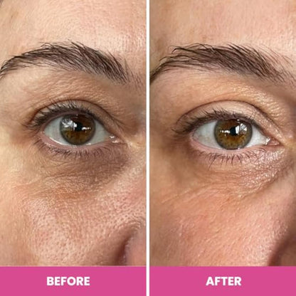 Prime Prometics PrimeEyes Hydrate Under Eye Cream for Mature Women – Hydrating Eye Cream for Dark Circles and Wrinkle Repair – Soft, Glowing & Healthy Under Eyes