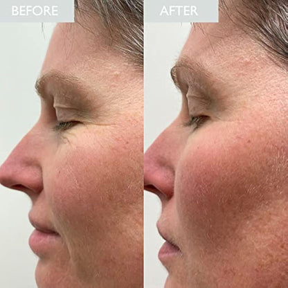 SKINICIAN Muli-Molecular Hyaluronic Elixir