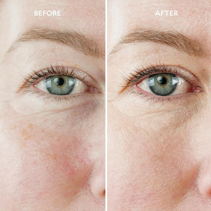 Gatineau - Miracle Eye Contour Cream, Conceal Dark Circles, Hydrating with Hyaluronic Acid & Vitamin E (11ml x 2)