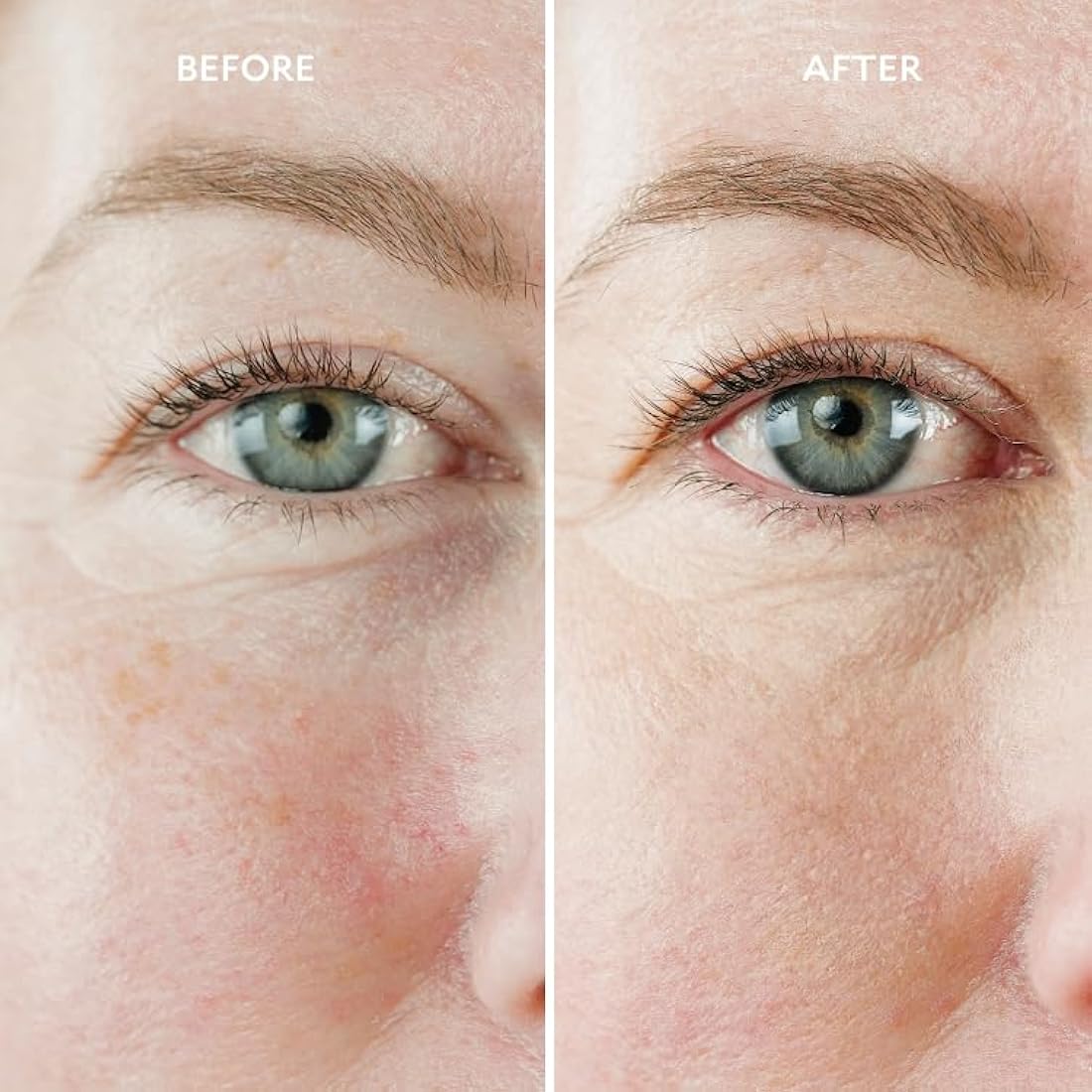 Gatineau - Miracle Eye & Face Contour Cream (11ml), Conceal Dark Circles, Hydrating with Hyaluronic Acid & Vitamin E