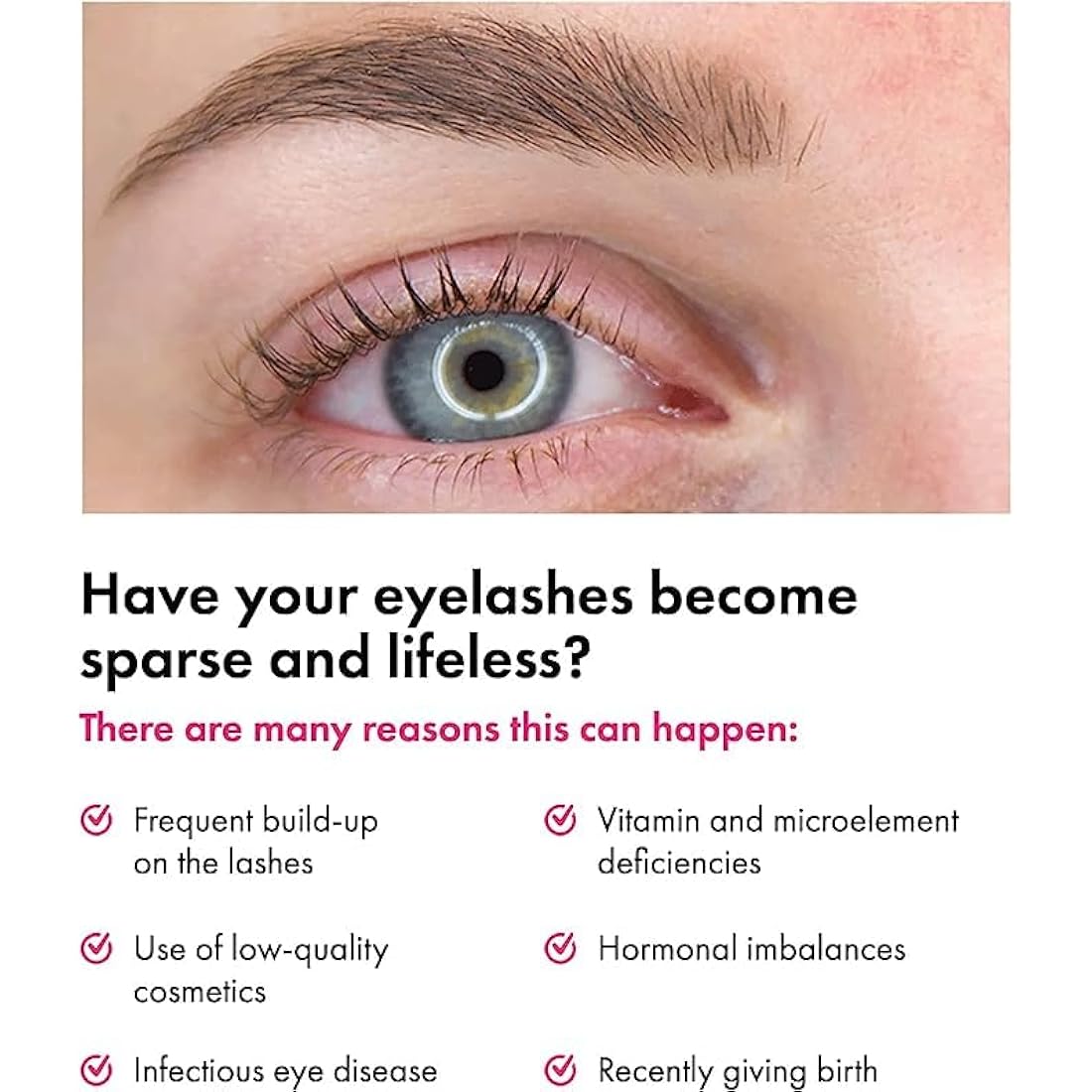 TOPLASH Eyelash Growth Serum - Innovative Eyelash and Eyebrow Growth Serum for Longer, Thicker, Fuller Brows & Lash Boost - Natural, Cruelty-Free & Hypoallergenic - 0.10 fl.oz.