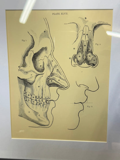 Victorian Anatomy Engraving – Antique Medical Print L