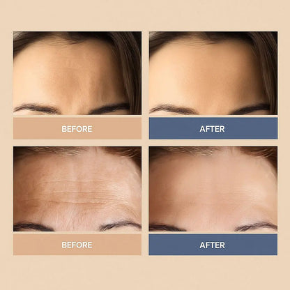 Brightr® Forehead wrinkle smoothing Face Tape (30 patches)