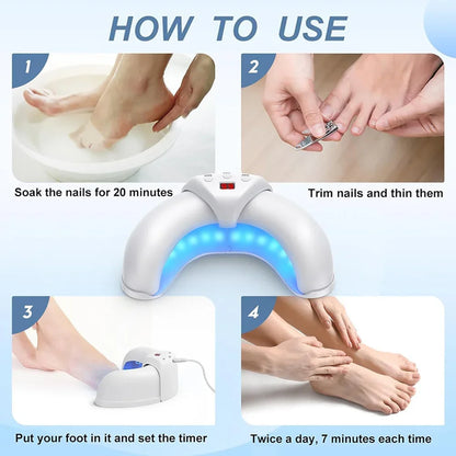 New Fungal Nail Laser Device Repair Toenail Fingernail Treatment Anti Fungus Infection Paronychia Onychomycosis Ingrown Toenail
