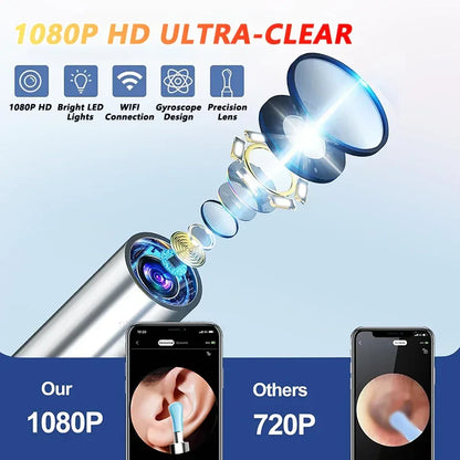 Visual Ear Wax Cleaner with Camera Safe Earwax Removal Endoscope with 5M Camera Luminous Otoscope Ear Cleaning Tools Ear Care