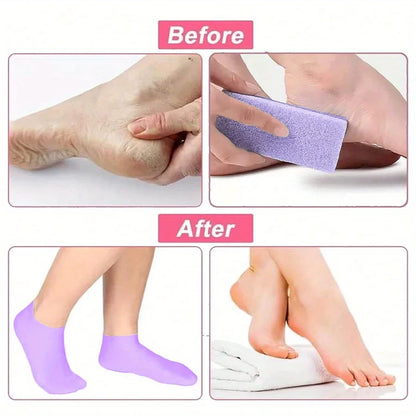 Moisturizing Foot Socks,Silicone Socks for Dry Cracked Feet Women's Foot Socks for Moisturizing,Featuring Massage