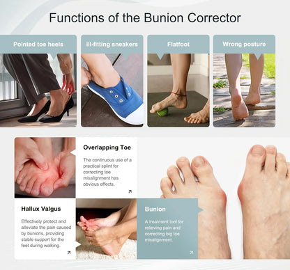 Big Toe Orthopedic Toe Straightener Hallux Valgus Orthotics Adjuster Correction Bunions Corrector for Left & Right Feet Rotatabl
